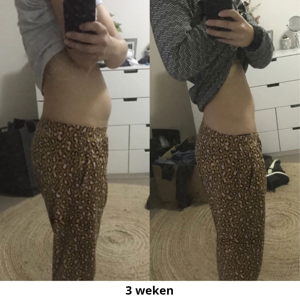 KH-NL-EM-Before-afters