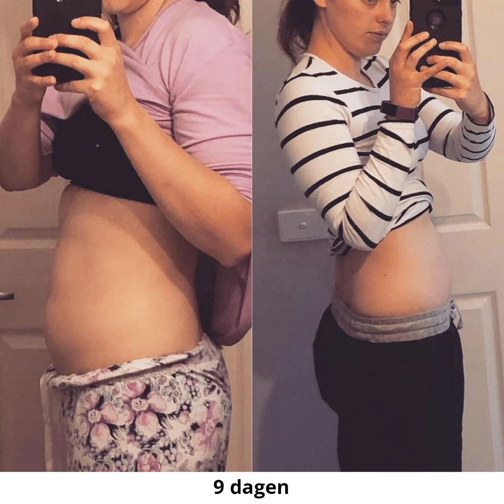 KH-nl-EM-Before-afters3